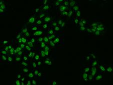 ZKSCAN2 Antibody - Immunofluorescence staining of ZKSCAN2 in HepG2 cells. Cells were fixed with 4% PFA, permeabilzed with 0.3% Triton X-100 in PBS, blocked with 10% serum, and incubated with rabbit anti-Human ZKSCAN2 polyclonal antibody (dilution ratio 1:200) at 4°C overnight. Then cells were stained with the Alexa Fluor 488-conjugated Goat Anti-rabbit IgG secondary antibody (green). Positive staining was localized to Nucleus.