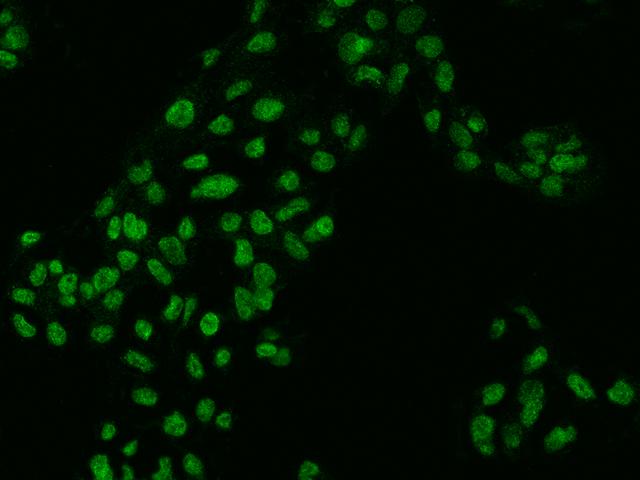ZKSCAN2 Antibody - Immunofluorescence staining of ZKSCAN2 in HepG2 cells. Cells were fixed with 4% PFA, permeabilzed with 0.3% Triton X-100 in PBS, blocked with 10% serum, and incubated with rabbit anti-Human ZKSCAN2 polyclonal antibody (dilution ratio 1:200) at 4°C overnight. Then cells were stained with the Alexa Fluor 488-conjugated Goat Anti-rabbit IgG secondary antibody (green). Positive staining was localized to Nucleus.