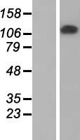 ZKSCAN2 Protein - Western validation with an anti-DDK antibody * L: Control HEK293 lysate R: Over-expression lysate