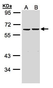 ZKSCAN3 / ZNF306 Antibody - Sample (30 ug whole cell lysate). A: HeLa S3, B: Hep G2 . 7.5% SDS PAGE. ZKSCAN3 / ZNF306 antibody diluted at 1:1000
