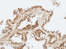 ZKSCAN3 / ZNF306 Antibody - IHC of paraffin-embedded normal lung using ZKSCAN3 antibody at 1:100 dilution.