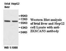 ZKSCAN3 / ZNF306 Antibody