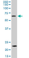 ZKSCAN3 / ZNF306 Antibody - ZKSCAN3 monoclonal antibody (M16), clone 2A5. Western blot of ZKSCAN3 expression in HepG2.