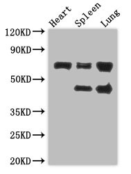 ZKSCAN3 / ZNF306 Antibody - Positive WB detected in:Mouse heart tissue,Mouse spleen tissue,Mouse lung tissue;All lanes: ZKSCAN3 antibody at 4?g/ml;Secondary;Goat polyclonal to rabbit IgG at 1/50000 dilution;predicted band size: 61,44 kDa;observed band size: 61,44 kDa;