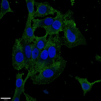 ZKSCAN3 / ZNF306 Antibody - Immunofluorescent analysis of Hela cells using ZKSCAN3 Antibody at a dilution of 1:100 and Alexa Fluor 488-congugated AffiniPure Goat Anti-Rabbit IgG(H+L)