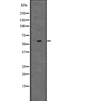 ZKSCAN3 / ZNF306 Antibody - Western blot analysis of ZKSCAN3 using Jurkat whole lysates.