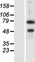 ZKSCAN3 / ZNF306 Protein - Western validation with an anti-DDK antibody * L: Control HEK293 lysate R: Over-expression lysate