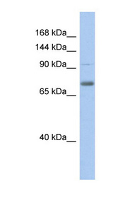 ZKSCAN5 Antibody - ZKSCAN5 / ZFP95 antibody Western blot of Fetal Stomach lysate. This image was taken for the unconjugated form of this product. Other forms have not been tested.