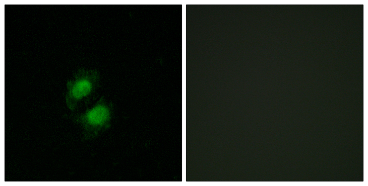 ZKSCAN5 Antibody - Immunofluorescence analysis of A549 cells, using ZNF95 Antibody. The picture on the right is blocked with the synthesized peptide.
