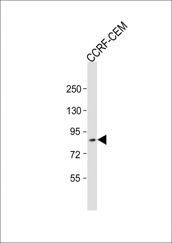 ZKSCAN5 Antibody - Anti-ZKSCAN5 Antibody (N-Term) at 1:2000 dilution + CCRF-CEM whole cell lysate Lysates/proteins at 20 ug per lane. Secondary Goat Anti-Rabbit IgG, (H+L), Peroxidase conjugated at 1:10000 dilution. Predicted band size: 97 kDa. Blocking/Dilution buffer: 5% NFDM/TBST.