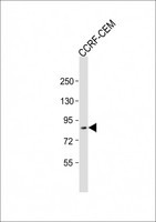 ZKSCAN5 Antibody - Anti-ZKSCAN5 Antibody (N-Term) at 1:2000 dilution + CCRF-CEM whole cell lysate Lysates/proteins at 20 ug per lane. Secondary Goat Anti-Rabbit IgG, (H+L), Peroxidase conjugated at 1:10000 dilution. Predicted band size: 97 kDa. Blocking/Dilution buffer: 5% NFDM/TBST.