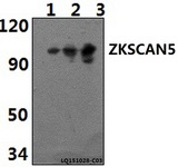ZKSCAN5 Antibody - Western blot of ZKSCAN5 polyclonal antibody at 1:500 dilution. Lane 1: RAW264.7 whole cell lysate (40 ug). Lane 2: HeLa whole cell lysate (40 ug). Lane 3: H9C2 whole cell lysate (40 ug).