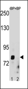 ZMAT1 Antibody - ZMAT1 Antibody western blot of HepG2 cell line lysates (35 ug/lane). The ZMAT1 antibody detected the ZMAT1 protein (arrow).