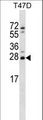 ZMAT2 Antibody - ZMAT2 Antibody western blot of T47D cell line lysates (35 ug/lane). The ZMAT2 antibody detected the ZMAT2 protein (arrow).