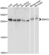 ZMAT2 Antibody - Western blot analysis of extracts of various cell lines, using ZMAT2 antibody at 1:1000 dilution. The secondary antibody used was an HRP Goat Anti-Rabbit IgG (H+L) at 1:10000 dilution. Lysates were loaded 25ug per lane and 3% nonfat dry milk in TBST was used for blocking. An ECL Kit was used for detection and the exposure time was 10s.