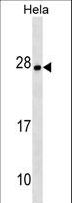 ZMAT4 Antibody - ZMAT4 Antibody western blot of HeLa cell line lysates (35 ug/lane). The ZMAT4 antibody detected the ZMAT4 protein (arrow).