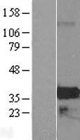 ZMAT4 Protein - Western validation with an anti-DDK antibody * L: Control HEK293 lysate R: Over-expression lysate
