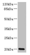 ZMAT5 Antibody - Western blot All lanes: ZMAT5 antibody at 5µg/ml + Colo320 whole cell lysate Secondary Goat polyclonal to rabbit IgG at 1/10000 dilution Predicted band size: 20 kDa Observed band size: 20 kDa