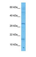 ZMAT5 Antibody - Western blot of ZMAT5 Antibody with human Thymus Tumor lysate.  This image was taken for the unconjugated form of this product. Other forms have not been tested.
