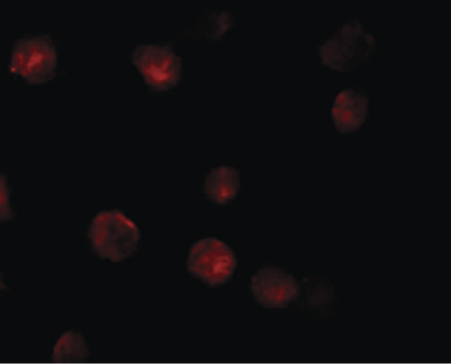 ZMIZ1 Antibody - Immunofluorescence of ZIMP10 in K562 cells with ZIMP10 antibody at 20 ug/ml.