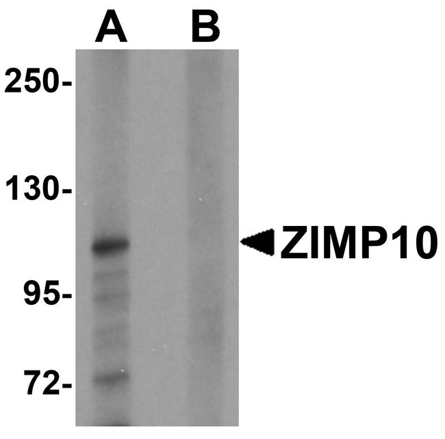ZMIZ1 Antibody - Western blot analysis of ZIMP10 in K562 cell lysate with ZIMP10 antibody at 0.5 ug/ml in (A) the absence and (B) the presence of blocking peptide