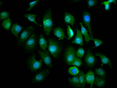 ZMIZ1 Antibody - Immunofluorescence staining of A549 cells diluted at 1:266, counter-stained with DAPI. The cells were fixed in 4% formaldehyde, permeabilized using 0.2% Triton X-100 and blocked in 10% normal Goat Serum. The cells were then incubated with the antibody overnight at 4°C.The Secondary antibody was Alexa Fluor 488-congugated AffiniPure Goat Anti-Rabbit IgG (H+L).