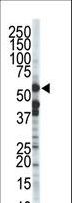 ZMPSTE24 Antibody - The anti-ZMPSTE24 antibody is used in Western blot to detect ZMPSTE24 in T-47D cell lysate.