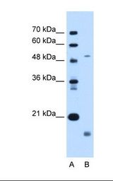 ZMPSTE24 Antibody - Lane A: Marker. Lane B: Jurkat cell lysate. Antibody concentration: 0.5 ug/ml. Gel concentration: 12%.  This image was taken for the unconjugated form of this product. Other forms have not been tested.