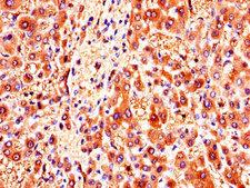 ZMPSTE24 Antibody - Immunohistochemistry of paraffin-embedded human liver tissue using ZMPSTE24 Antibody at dilution of 1:100