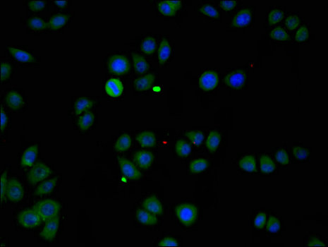 ZMPSTE24 Antibody - Immunofluorescent analysis of PC3 cells using ZMPSTE24 Antibody at a dilution of 1:100 and Alexa Fluor 488-congugated AffiniPure Goat Anti-Rabbit IgG(H+L)