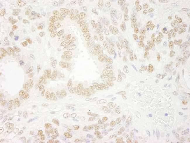 ZMYM2 / RAMP Antibody - Detection of Mouse ZNF198 by Immunohistochemistry. Sample: FFPE section of mouse teratoma. Antibody: Affinity purified rabbit anti-ZNF198 used at a dilution of 1:250.