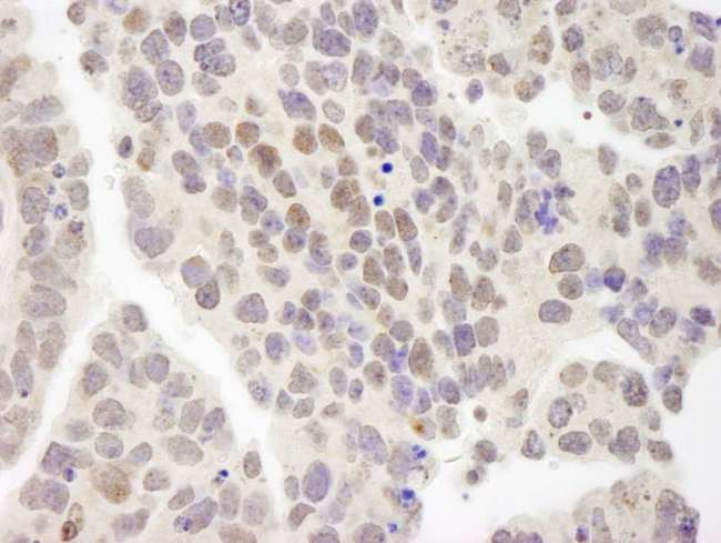 ZMYM3 Antibody - Detection of Mouse ZNF261 by Immunohistochemistry. Sample: FFPE section of mouse teratoma. Antibody: Affinity purified rabbit anti-ZNF261 used at a dilution of 1:250.