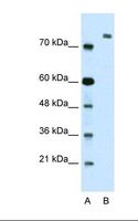 ZMYM3 Antibody - Lane A: Marker. Lane B: Transfected 293T cell lysate. Antibody concentration: 2.5 ug/ml. Gel concentration: 12%.  This image was taken for the unconjugated form of this product. Other forms have not been tested.