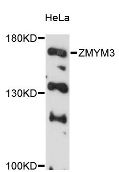 ZMYM3 Antibody - Western blot analysis of extracts of HeLa cells, using ZMYM3 antibody at 1:3000 dilution. The secondary antibody used was an HRP Goat Anti-Rabbit IgG (H+L) at 1:10000 dilution. Lysates were loaded 25ug per lane and 3% nonfat dry milk in TBST was used for blocking. An ECL Kit was used for detection and the exposure time was 90s.