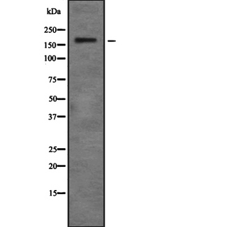 ZMYM4 / ZNF262 Antibody - Western blot analysis of ZNF262 using HepG2 whole cells lysates