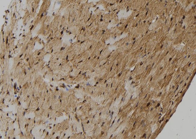ZMYM4 / ZNF262 Antibody - 1:100 staining mouse heart tissue by IHC-P. The sample was formaldehyde fixed and a heat mediated antigen retrieval step in citrate buffer was performed. The sample was then blocked and incubated with the antibody for 1.5 hours at 22°C. An HRP conjugated goat anti-rabbit antibody was used as the secondary.