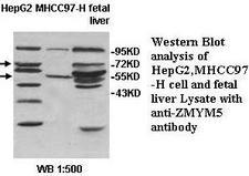 ZMYM5 Antibody
