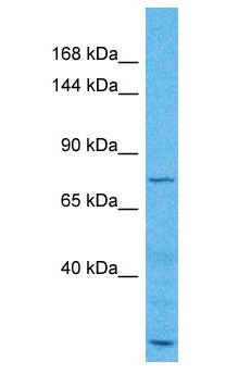 ZMYM6 Antibody - ZMYM6 antibody Western Blot of Lung Tumor. Antibody dilution: 1 ug/ml.  This image was taken for the unconjugated form of this product. Other forms have not been tested.