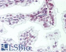 ZMYM6 Antibody - Human Prostate: Formalin-Fixed, Paraffin-Embedded (FFPE).  This image was taken for the unconjugated form of this product. Other forms have not been tested.