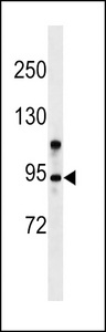 ZMYM6 Antibody - ZMYM6 Antibody western blot of Jurkat cell line lysates (35 ug/lane). The ZMYM6 antibody detected the ZMYM6 protein (arrow).
