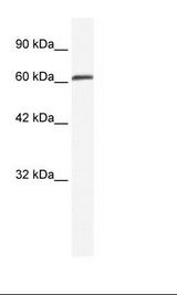 ZMYM6 Antibody - Jurkat Cell Lysate.  This image was taken for the unconjugated form of this product. Other forms have not been tested.