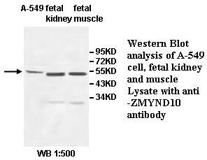 ZMYND10 Antibody