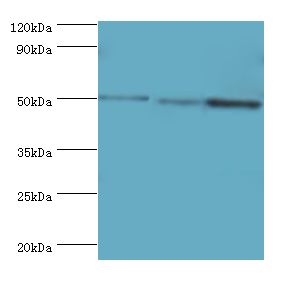 ZMYND10 Antibody - Western blot. All lanes: ZMYND10 antibody at 8 ug/ml. Lane 1: A549 whole cell lysate. Lane 2: mouse kidney tissue. Lane 3: mouse skeletal muscle tissue. secondary Goat polyclonal to rabbit at 1:10000 dilution. Predicted band size: 50 kDa. Observed band size: 50 kDa.