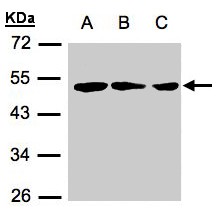 ZMYND10 Antibody - Sample (30 ug of whole cell lysate). A:239T, B: A431, C: H1299. 12% SDS PAGE. ZMYND10 antibody diluted at 1:500