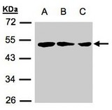 ZMYND10 Antibody - Sample (30 ug of whole cell lysate). A:239T, B: A431, C: H1299. 12% SDS PAGE. ZMYND10 antibody diluted at 1:500