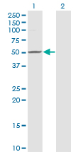 ZMYND10 Antibody - Western blot of ZMYND10 expression in transfected 293T cell line by ZMYND10 monoclonal antibody (M24), clone 3D11.