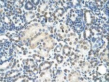 ZMYND11 / BS69 Antibody - ZMYND11 / BS69 antibody ARP34705_T100-AAH12586-ZMYND11(zinc finger, MYND domain containing 11) Antibody was used in IHC to stain formalin-fixed, paraffin-embedded human kidney.  This image was taken for the unconjugated form of this product. Other forms have not been tested.