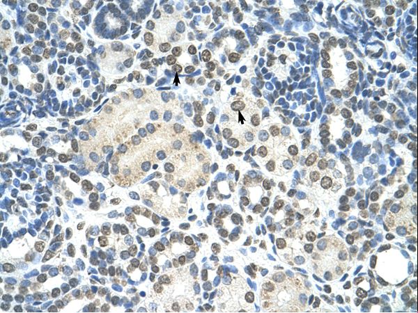 ZMYND11 / BS69 Antibody - ZMYND11 / BS69 antibody ARP34705_T100-AAH12586-ZMYND11(zinc finger, MYND domain containing 11) Antibody was used in IHC to stain formalin-fixed, paraffin-embedded human kidney.  This image was taken for the unconjugated form of this product. Other forms have not been tested.