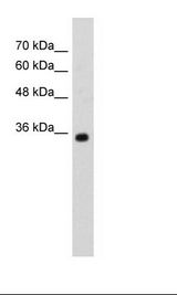 ZMYND11 / BS69 Antibody - HepG2 Cell Lysate.  This image was taken for the unconjugated form of this product. Other forms have not been tested.