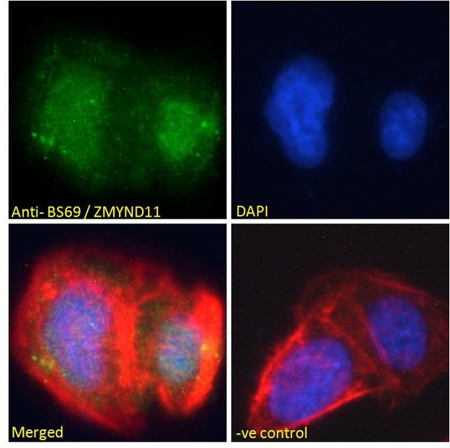 ZMYND11 / BS69 Antibody - ZMYND11 / BS69 antibody immunofluorescence analysis of paraformaldehyde fixed U2OS cells, permeabilized with 0.15% Triton. Primary incubation 1hr (10ug/ml) followed by Alexa Fluor 488 secondary antibody (2ug/ml), showing nuclear staining. Actin filaments were stained with phalloidin (red) and The nuclear stain is DAPI (blue). Negative control: Unimmunized goat IgG (10ug/ml) followed by Alexa Fluor 488 secondary antibody (2ug/ml).